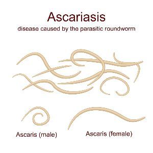 Askariasis