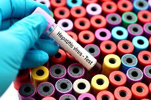 Hepatitis D