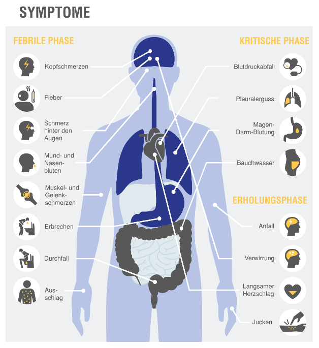 Dengue Fieber Symptome