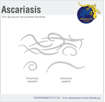 Ascariasis